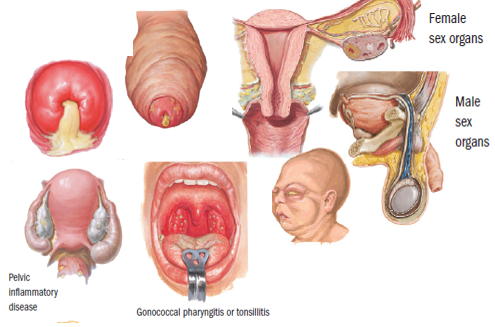 Obat Sipilis Raja Singa