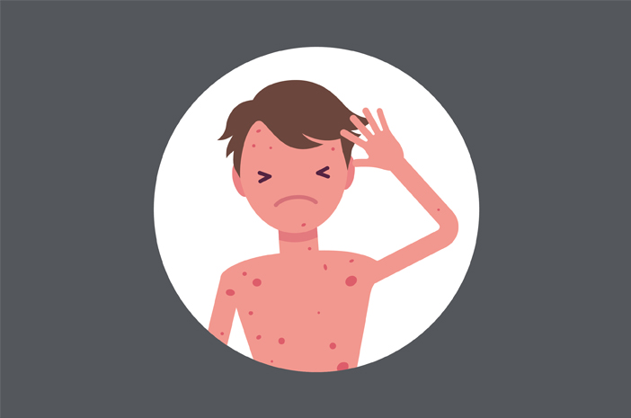 cara menyembuhkan sipilis secara alami